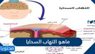 ماهو التهاب السحايا وأنواعه وأسبابه وكيفية علاجه