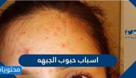 اسباب حبوب الجبهه وأفضل طرق منزلية لعلاجها