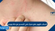 اسباب ظهور بقع حمراء في الجسم مع حكة وورم وكيفية علاجها