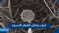 كيف ينتقل الفطر الاسود وكيف تتم معالجة الفطر الأسود
