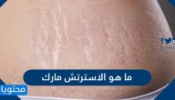 ما هو الاسترتش مارك واسباب ظهورها