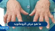 ما هو مرض الروماتويد وأسبابه وأعراضه وكيفية علاجه