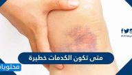 متى تكون الكدمات خطيرة وما الحالات التي تستدعي الرعاية الطبية