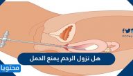 هل نزول الرحم يمنع الحمل وكيفية علاج نزول الرحم