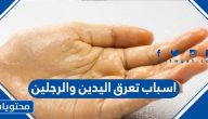 اسباب تعرق اليدين والرجلين وطرق علاج التعرق