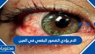 الام يؤدي الضمور البقعي في العين ؟ وطرق الوقاية من مرض التنكس البقعي