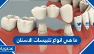 ما هي انواع تلبيسات الاسنان ؟ ونصائح عند تلبيس الأسنان