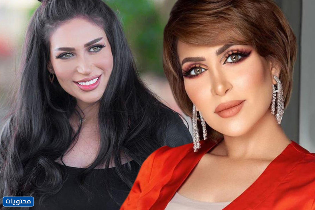 الدكتورة خلود قبل وبعد عمليات التجميل