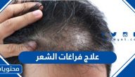 علاج فراغات الشعر بحسب السبب المؤدي للتساقط