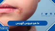 ما هو فيروس الهربس