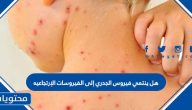هل ينتمي فيروس الجدري إلى الفيروسات الإرتجاعيه