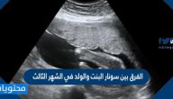 الفرق بين سونار البنت والولد في الشهر الثالث