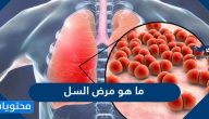 ما هو مرض السل