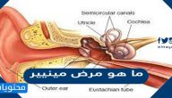 ما هو مرض مينيير واسبابه واعراضه