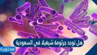 هل توجد جرثومة شيغيلا في السعودية