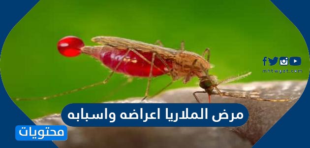 مرض الملاريا اعراضه واسبابه