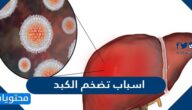 اسباب تضخم الكبد