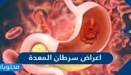 اعراض سرطان المعدة