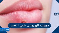 حبوب الهربس في الفم الاسباب وطرق العلاج