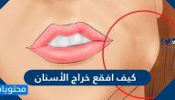 كيف افقع خراج الأسنان