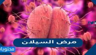 ما هو مرض السيلان ، اعراضه واسبابه