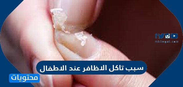سبب تآكل الاظافر عند الاطفال