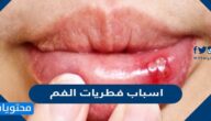 اسباب فطريات الفم