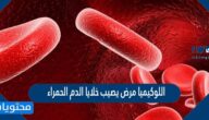 اللوكيميا مرض يصيب خلايا الدم الحمراء صح أم خطأ