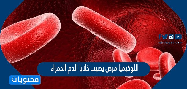 اللوكيميا مرض يصيب خلايا الدم الحمراء صح أم خطأ