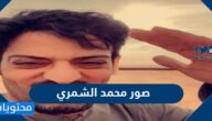 صور محمد الشمري وتفاصيل الحادث الذي تعرض له