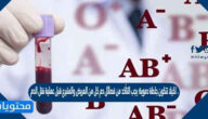 لكيلا تتكون جلطة دموية؛ يجب التأكد من فصائل دم كل من المريض والمتبرع قبل عملية نقل الدم . صح أم خطأ