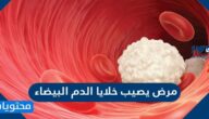 مرض يصيب خلايا الدم البيضاء