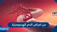 من امراض الدم الهيموفيليا