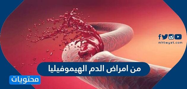 الهيموفيليا الدم من امراض طريقة الوقاية