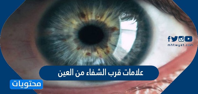 أعراض العين في البطن