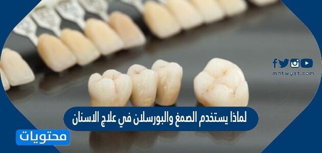 لماذا يستخدم الصمغ والبورسلان في علاج الاسنان
