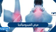 ما هو مرض الفيبروميالجيا وعلاجه