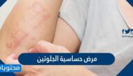ما هي حساسية الجلوتين