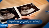 كيف اعرف نوع الجنين من ورقة السونار