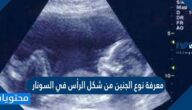 معرفة نوع الجنين من شكل الرأس في السونار