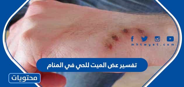 تفسير عض الميت للحي في المنام للعزباء والمتزوجة والحامل وللرجل