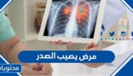 مرض يصيب الصدر
