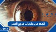 هل الحكة من علامات خروج العين