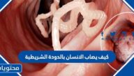 كيف يصاب الانسان بالدودة الشريطية