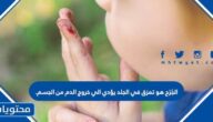 الجُرْح هو تمزق في الجلد يؤدي الي خروج الدم من الجسم. صح أم خطأ