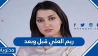 ريم العلي قبل وبعد