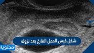 شكل كيس الحمل الفارغ بعد نزوله