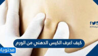كيف اعرف الكيس الدهني من الورم