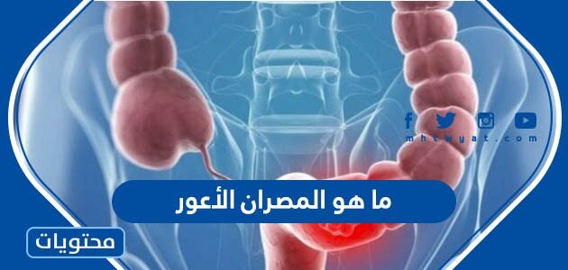 ما هو المصران الأعور