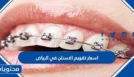 اسعار تقويم الاسنان في الرياض